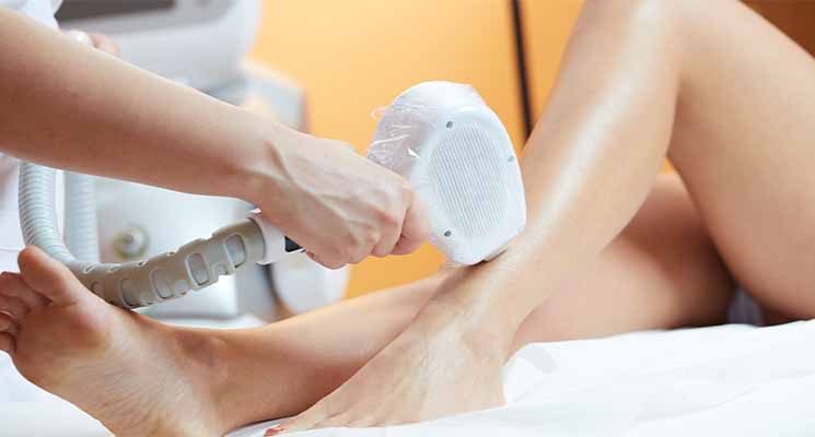 laserska epilacija lazarevac